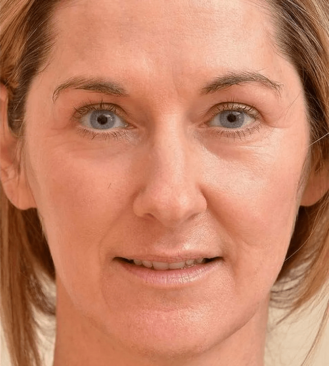 Aš atrodau jaunesnis, kai naudoju eudalie kremą