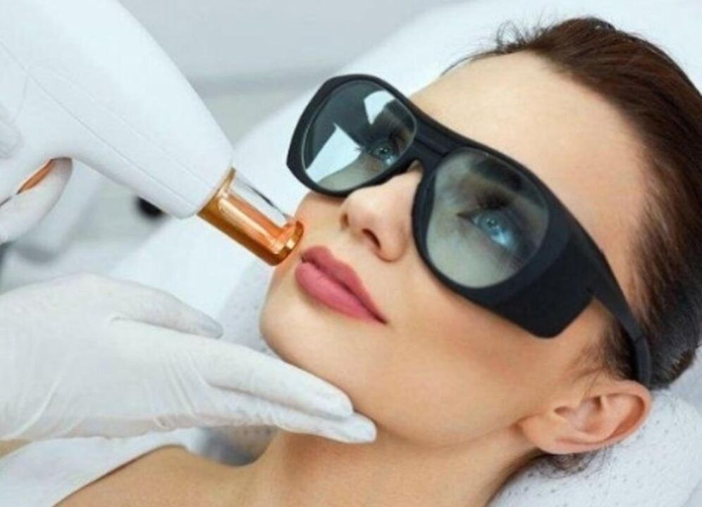 veido odos atjauninimas