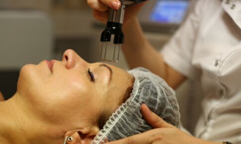 Frakcinė termolizė atjauninimui